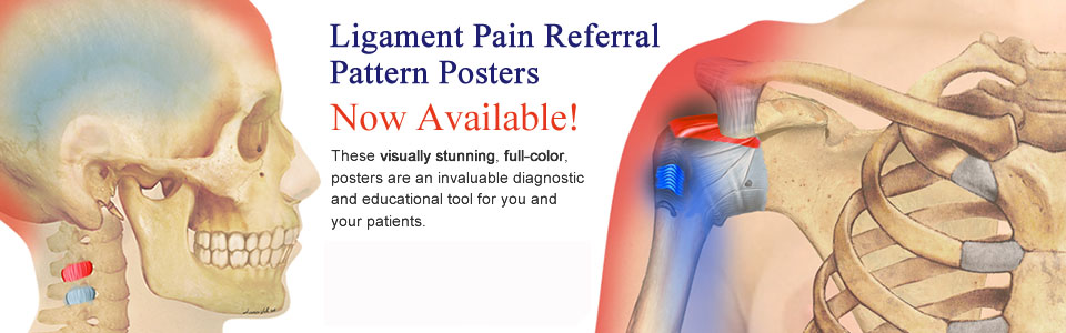 Ligament Pain Referral Pattern Poster Promo
