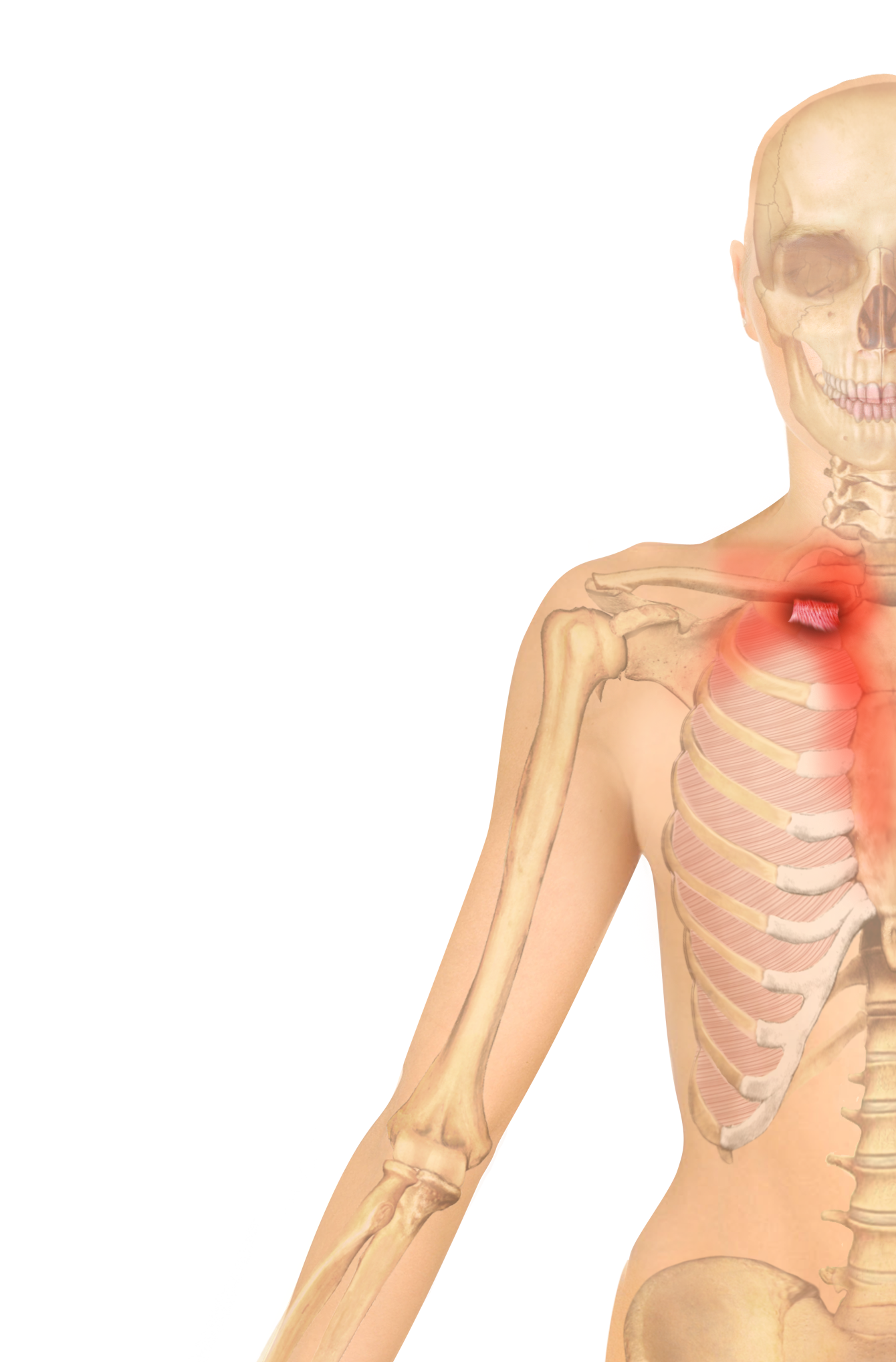 VIDEO INSIDE) Don't Forget About the Costoclavicular Ligament in