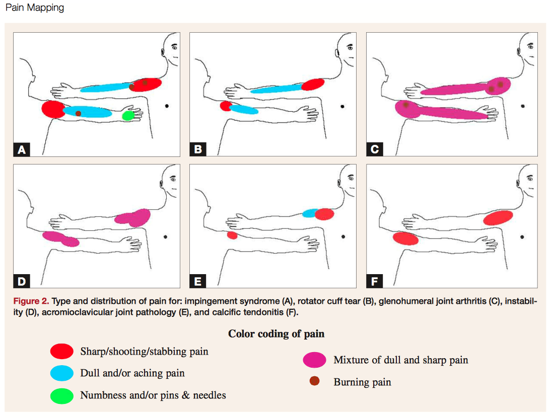 Shoulder Pain Referral Patterns image