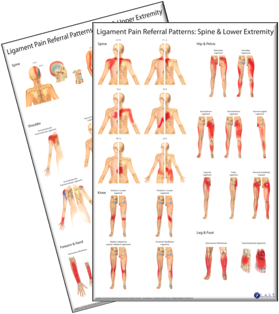 Visceral Referral Pattern Chart