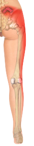 Posterior Iliolumbar Lig NB