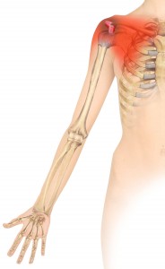 Anterior Acromioclavicular-coracoclavicular Ligaments