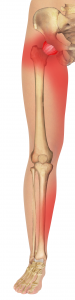 Anterior A-F Joint