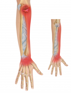 Posterior Radial collateral & Annular lig